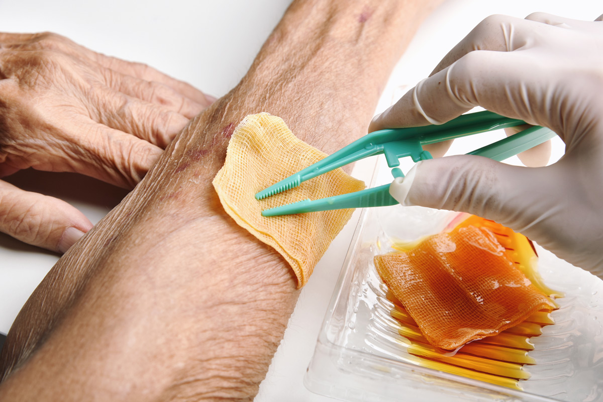 Waterbased gel to be tested as dressing for diabetic wounds Pharmacy