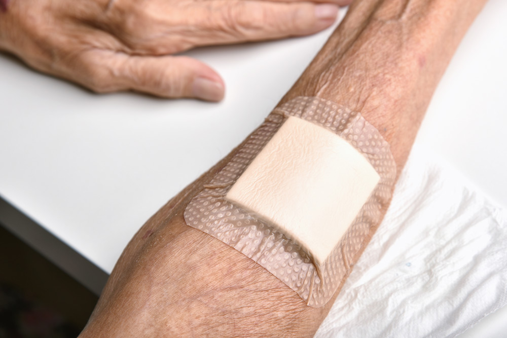 Bio-inspired, blood-repelling tissue glue could seal wounds